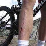 No Blood – no fun…